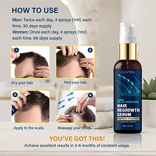 Minoksidil za muškarce i žene - 5% minoksidilni sprej za obnovanje kose - serum za rast kose