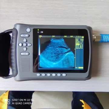 2023 Konveksna najnovija ultrazvučna mašina za trudnoću Prijenosni Ecografo Portatil Scanner Handheld Doppler
