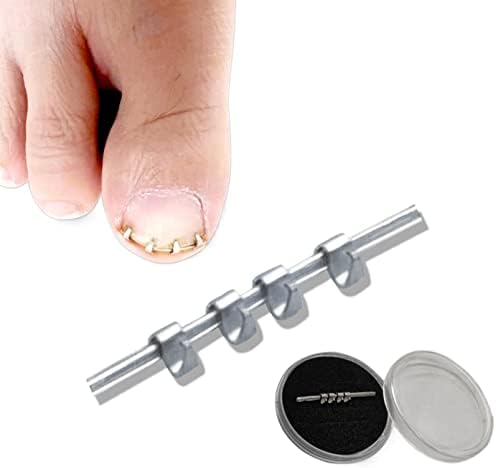 1 pakovanje profesionalne korekcije noktiju uraslih noktiju alat za fiksiranje žice za oporavak Paronihija